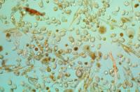 La microalga tóxica Dinophysis acuminata adapta su ciclo vital al sistema de afloramiento de las rías